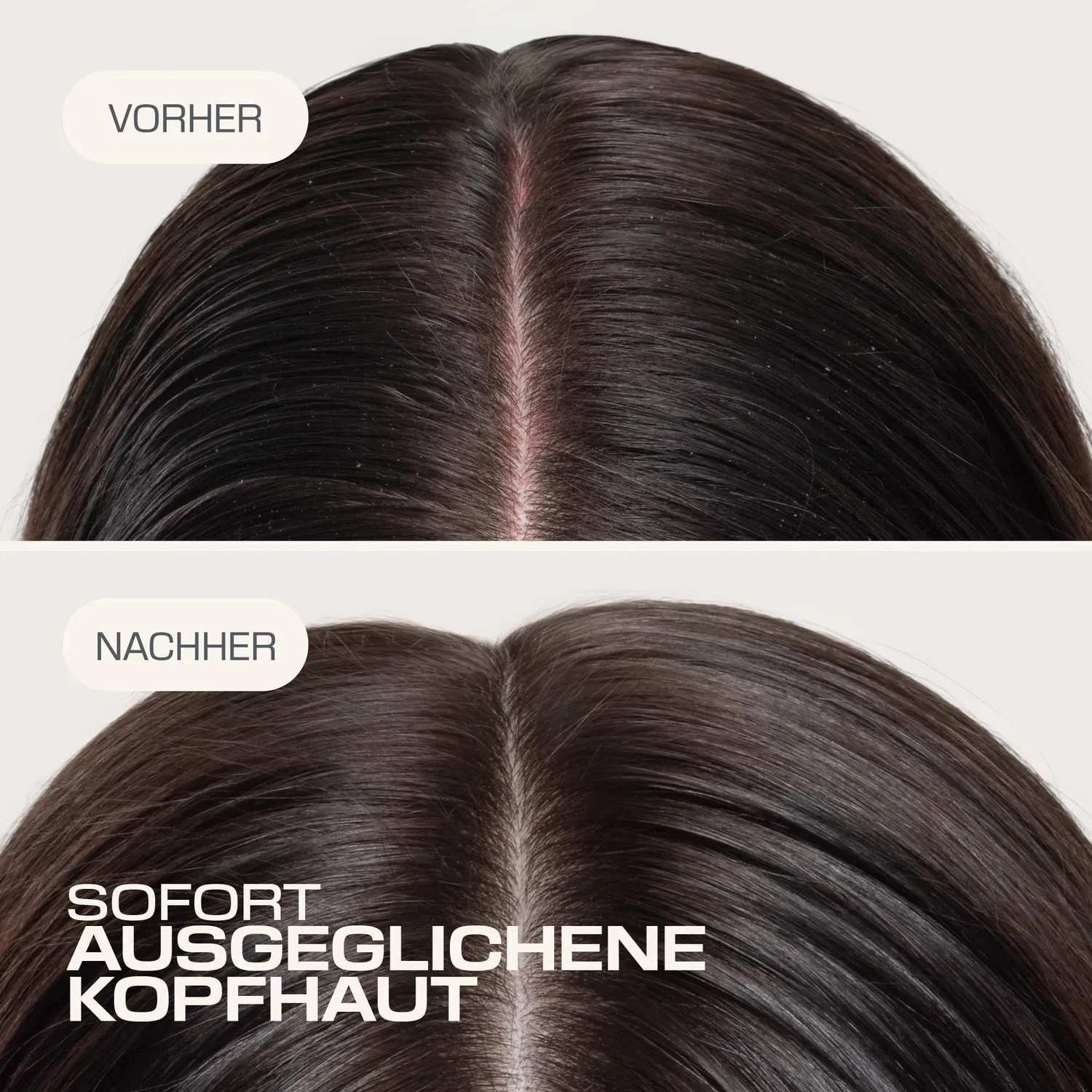 Goldwell Dualsenses Scalp Specialist Fluid trockene Kopfhaut