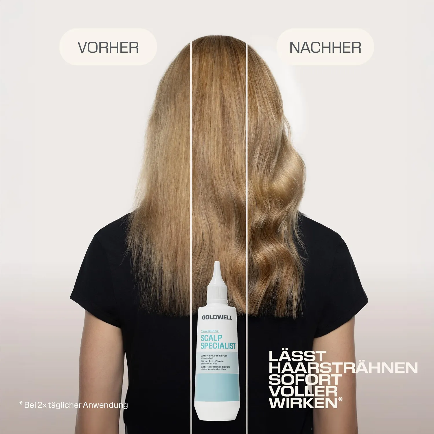 Goldwell Dualsenses Scalp Serum bei Haarausfall