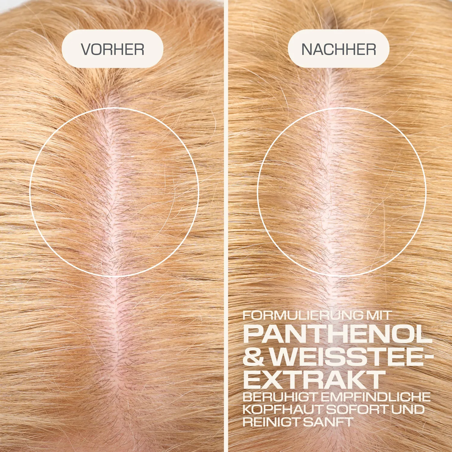 Goldwell Dualsenses Scalp Specialist Sensitive Schaum-Shampoo